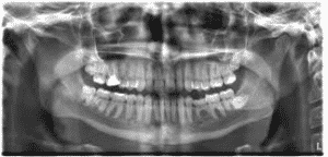 Latest Digital Dental X Rays 